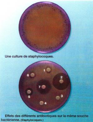 Antibiogramme