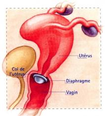 Diaphragme 1