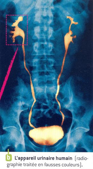 Radiographie appareil urinaire